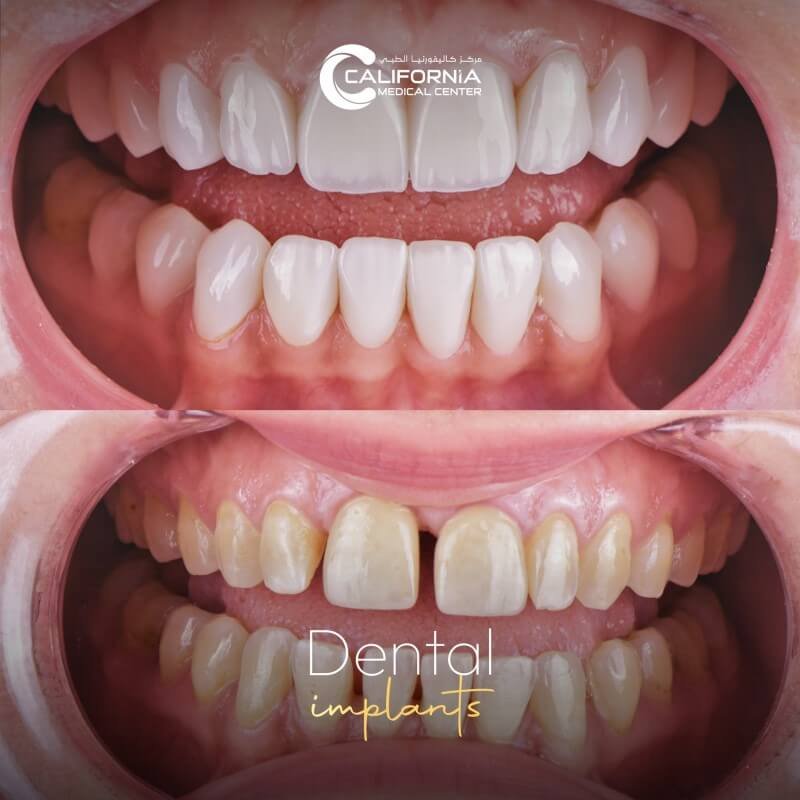 Before & After copy (1)